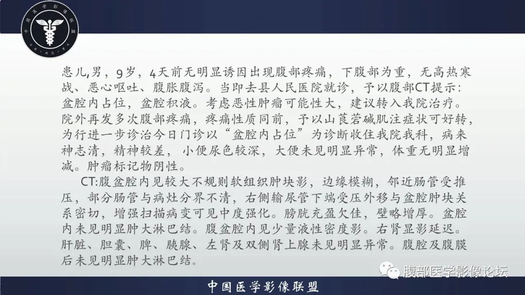 影像PPT - 【病例】促结缔组织增生性小圆细胞肿瘤DSRCT一例影像诊断-9