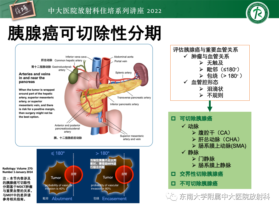 影像PPT - 【PPT】胰腺癌MDCT可切除性评估-8