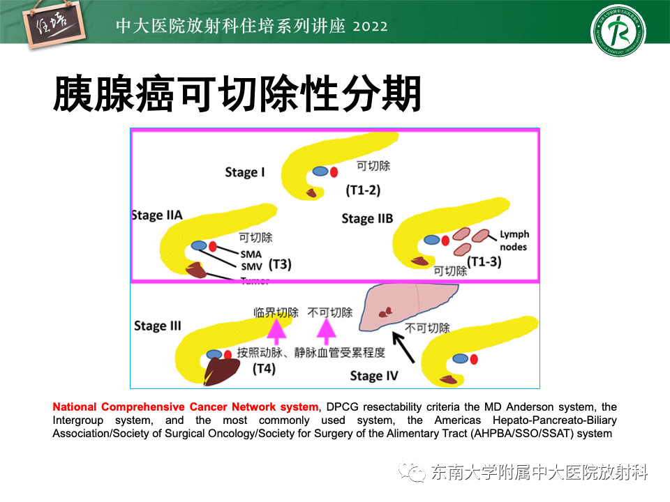 影像PPT - 【PPT】胰腺癌MDCT可切除性评估-6