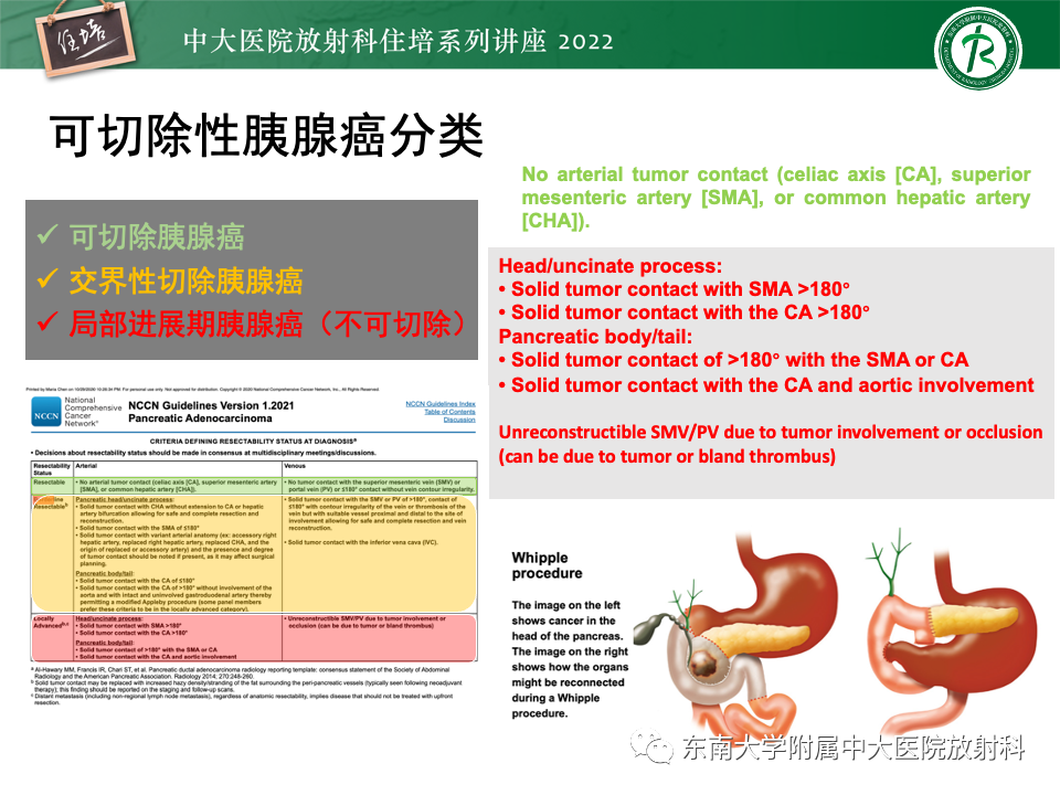 影像PPT - 【PPT】胰腺癌MDCT可切除性评估-10