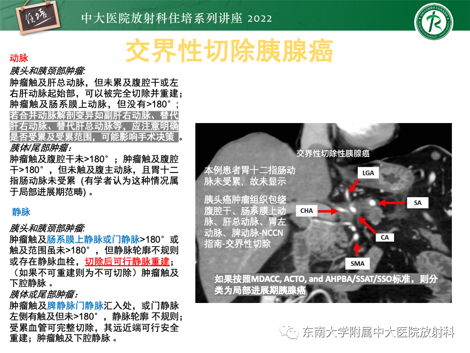 影像PPT - 【PPT】胰腺癌MDCT可切除性评估-13