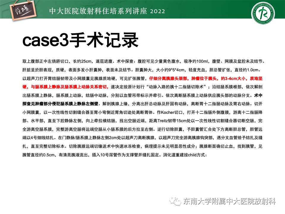 影像PPT - 【PPT】胰腺癌MDCT可切除性评估-26