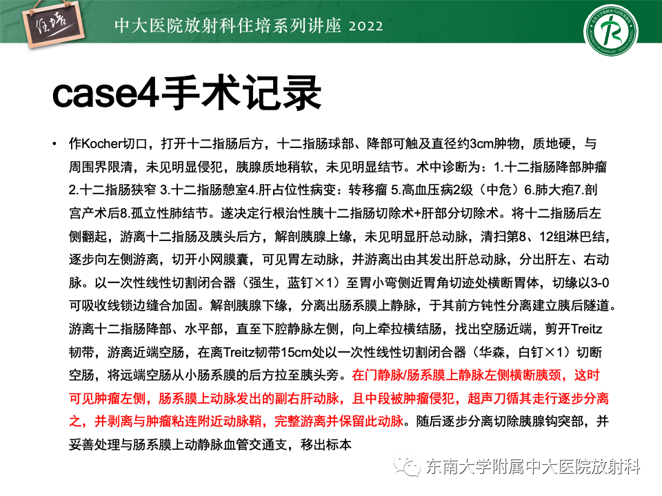 影像PPT - 【PPT】胰腺癌MDCT可切除性评估-29