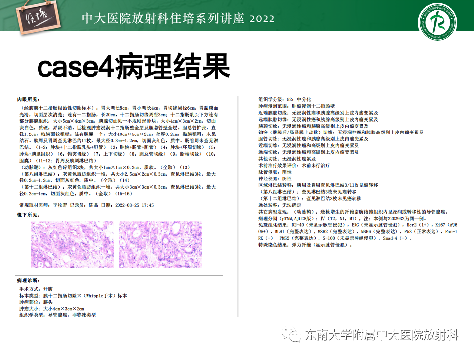 影像PPT - 【PPT】胰腺癌MDCT可切除性评估-30