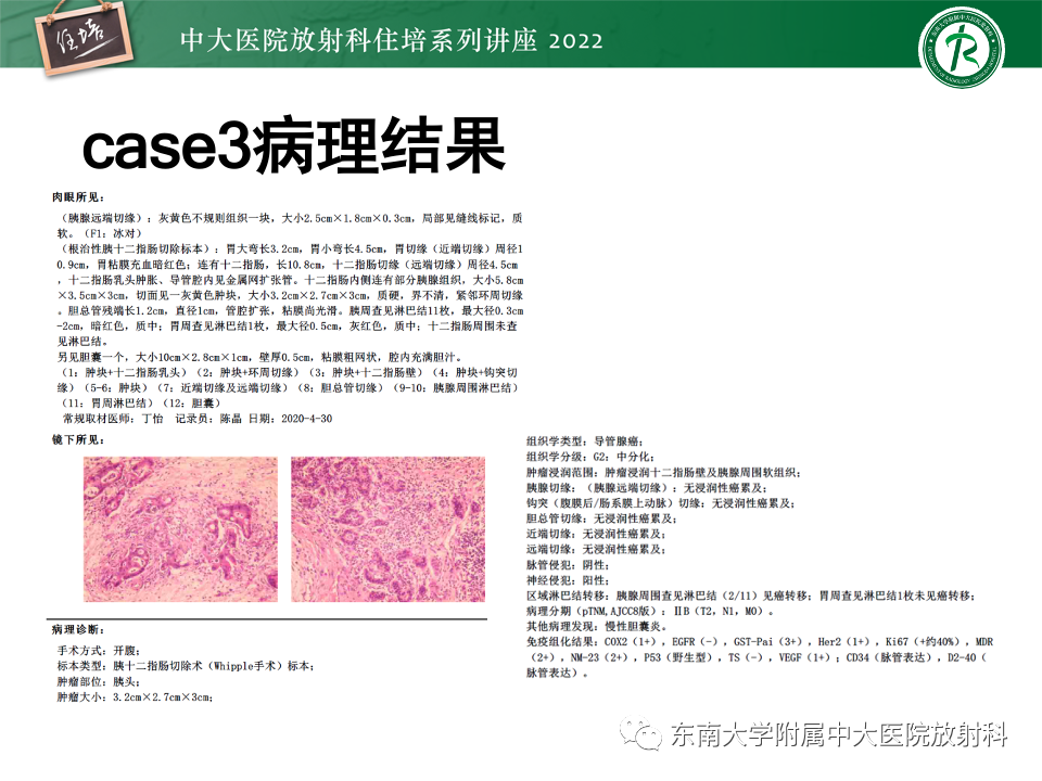 影像PPT - 【PPT】胰腺癌MDCT可切除性评估-27