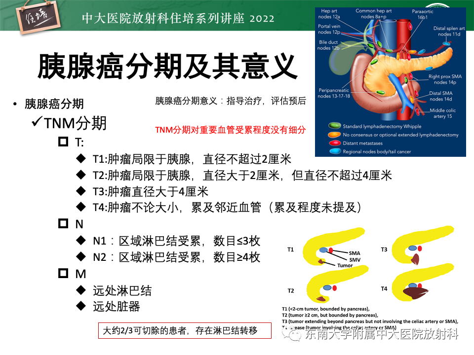 影像PPT - 【PPT】胰腺癌MDCT可切除性评估-4