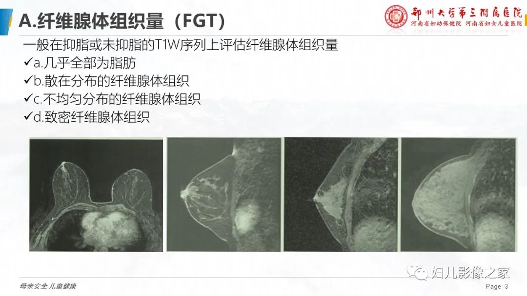 影像PPT - 【PPT】乳腺MRI诊断规范-3