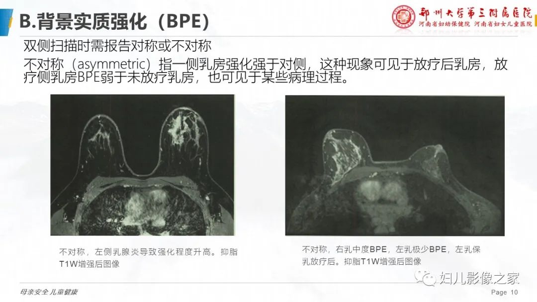 影像PPT - 【PPT】乳腺MRI诊断规范-10