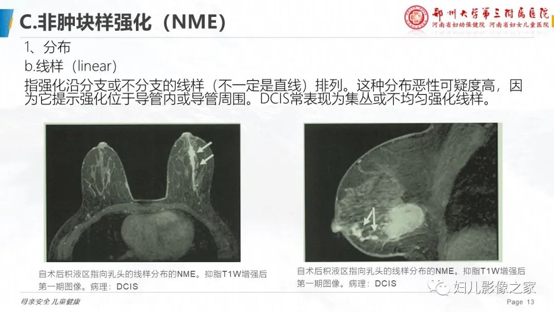 影像PPT - 【PPT】乳腺MRI诊断规范-13