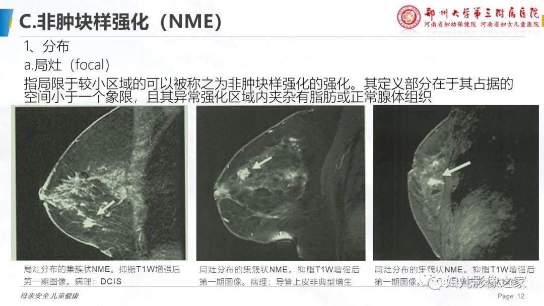 影像PPT - 【PPT】乳腺MRI诊断规范-12