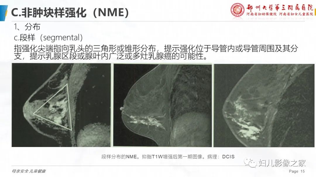 影像PPT - 【PPT】乳腺MRI诊断规范-15