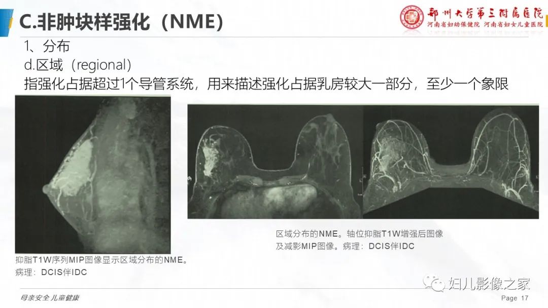 影像PPT - 【PPT】乳腺MRI诊断规范-17