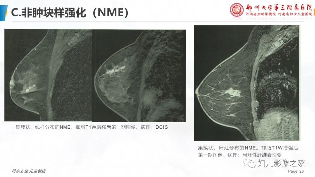 影像PPT - 【PPT】乳腺MRI诊断规范-26