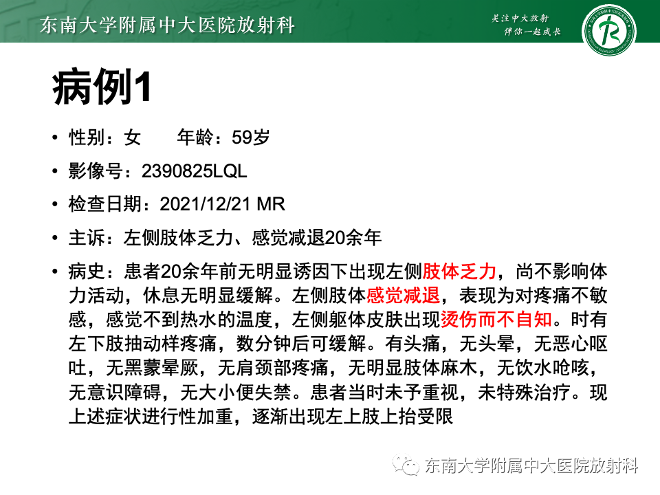 影像PPT - 【PPT】小脑扁桃体下疝畸形-2 影像PPT - 【PPT】小脑扁桃体下疝畸形-2