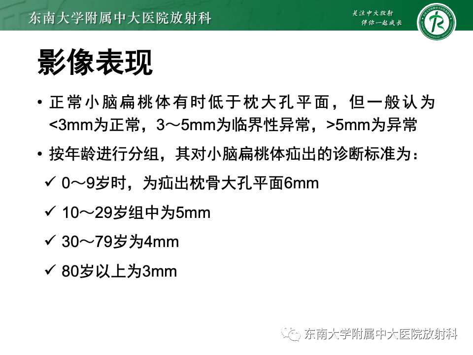 影像PPT - 【PPT】小脑扁桃体下疝畸形-9 影像PPT - 【PPT】小脑扁桃体下疝畸形-9