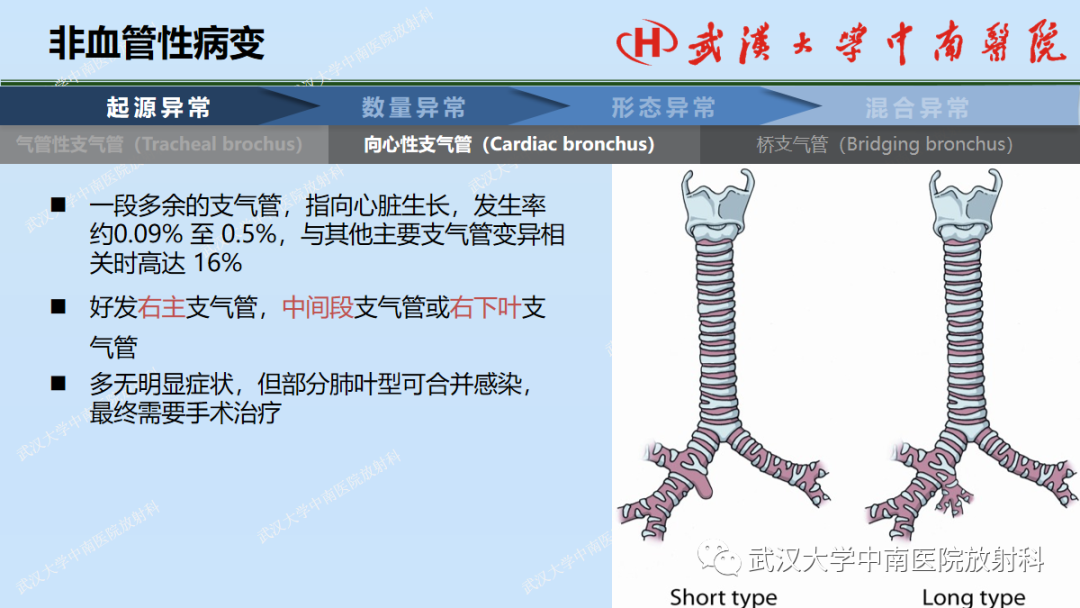 影像PPT - 【PPT】先天性气道异常-10