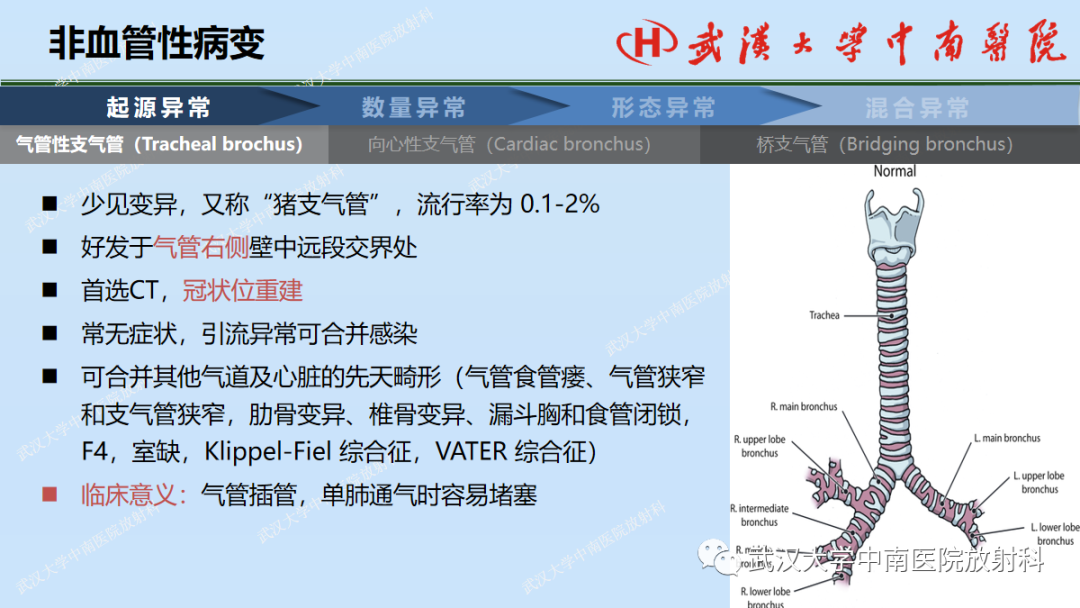 影像PPT - 【PPT】先天性气道异常-6