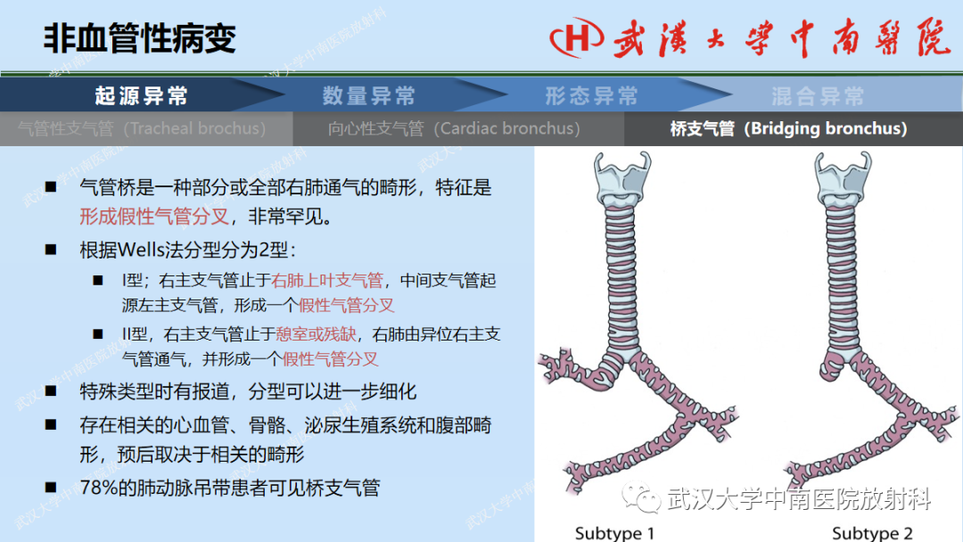 影像PPT - 【PPT】先天性气道异常-13