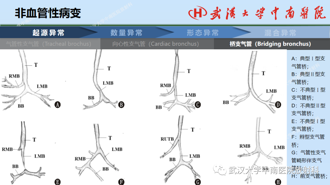 影像PPT - 【PPT】先天性气道异常-14