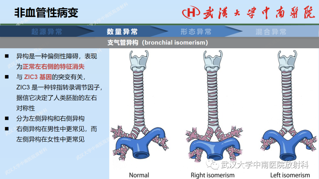 影像PPT - 【PPT】先天性气道异常-18