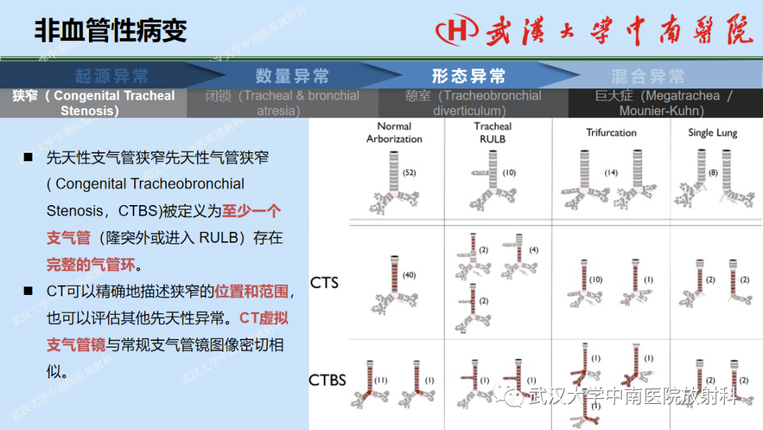 影像PPT - 【PPT】先天性气道异常-23