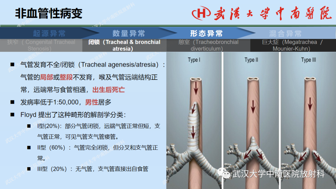 影像PPT - 【PPT】先天性气道异常-26