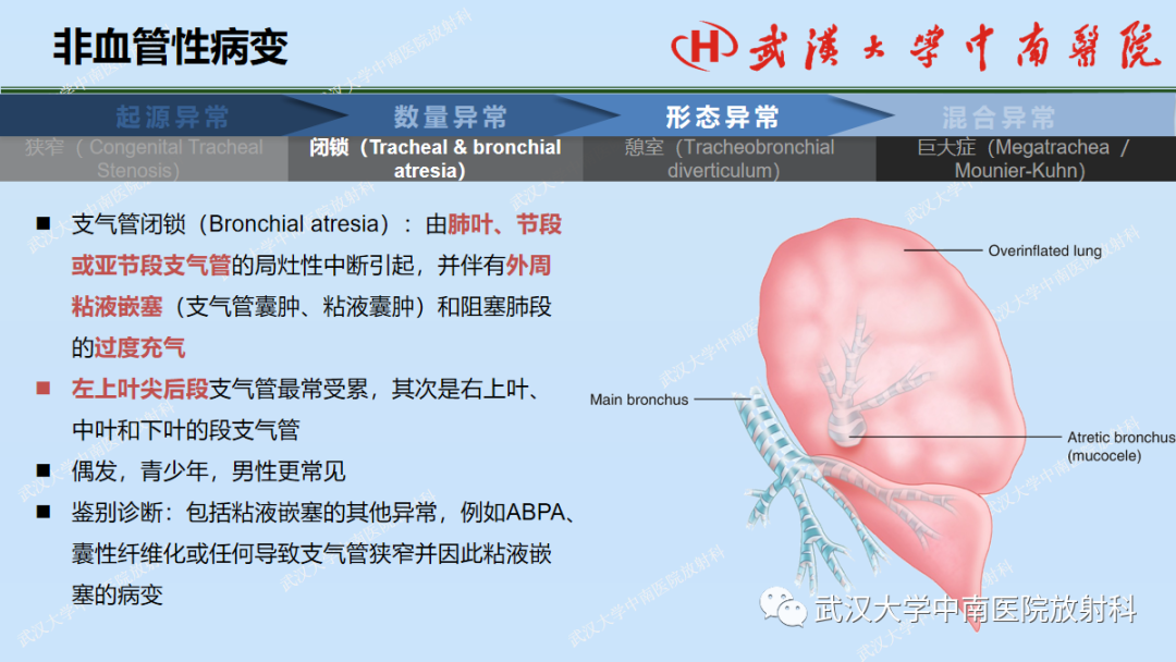 影像PPT - 【PPT】先天性气道异常-30