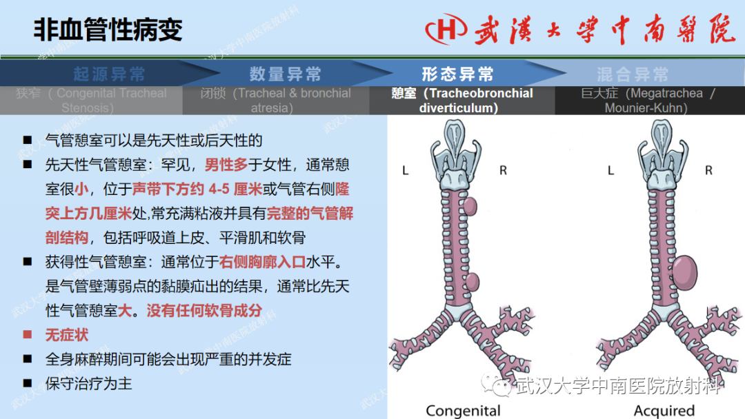 影像PPT - 【PPT】先天性气道异常-32