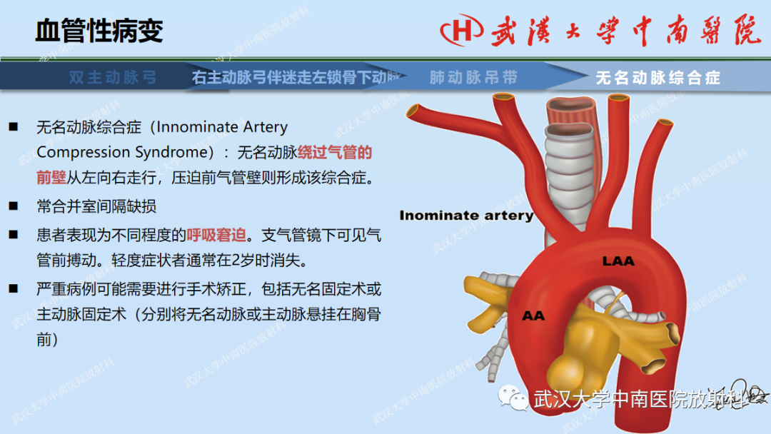 影像PPT - 【PPT】先天性气道异常-46