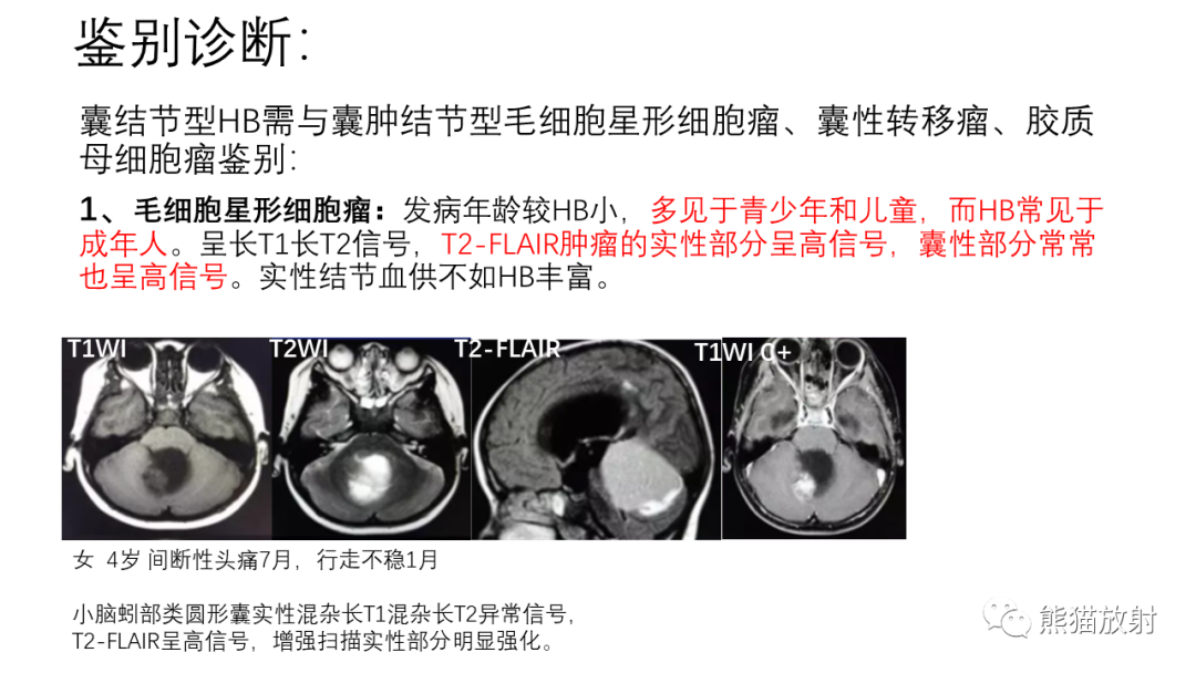 影像PPT - 【病例】后颅窝血管母细胞瘤2例MR-29