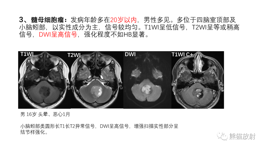 影像PPT - 【病例】后颅窝血管母细胞瘤2例MR-34