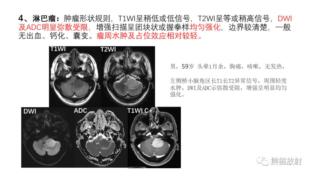 影像PPT - 【病例】后颅窝血管母细胞瘤2例MR-35