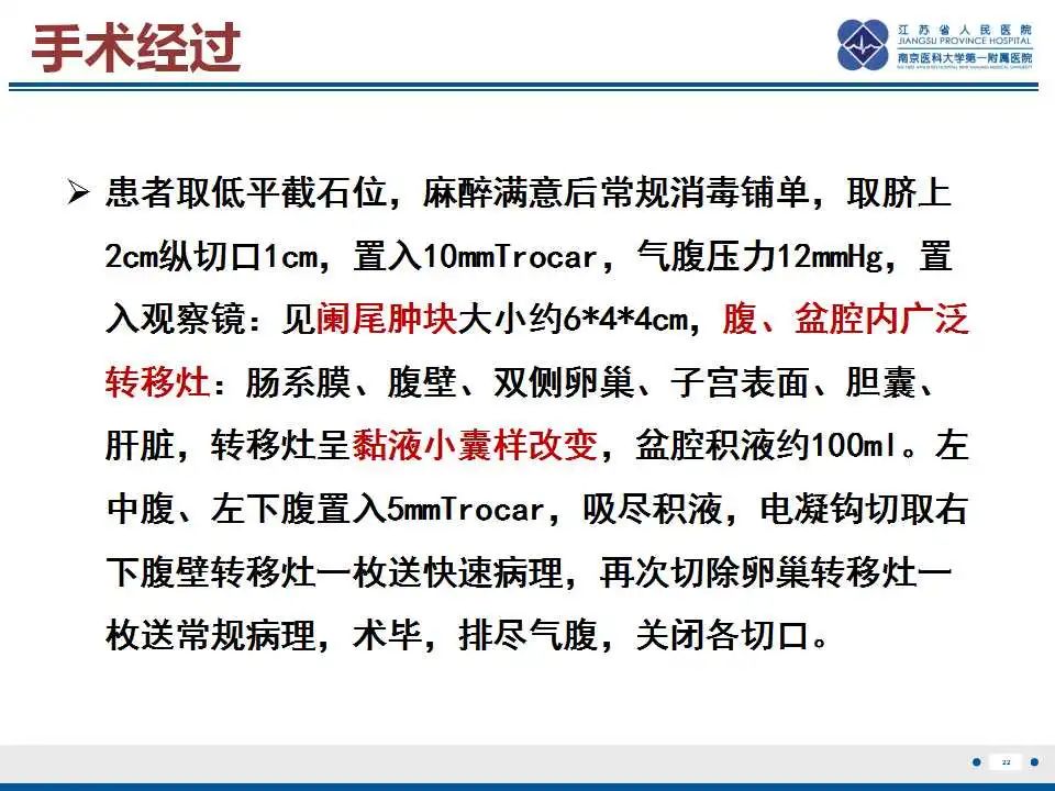 影像PPT - 【PPT】阑尾黏液性肿瘤-23