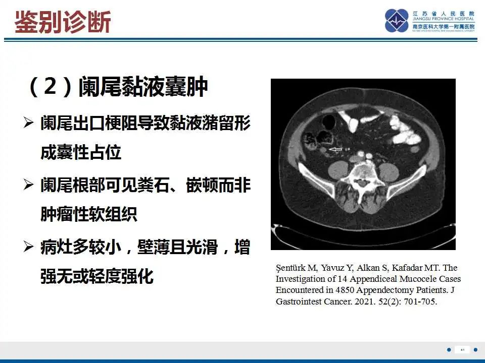影像PPT - 【PPT】阑尾黏液性肿瘤-42