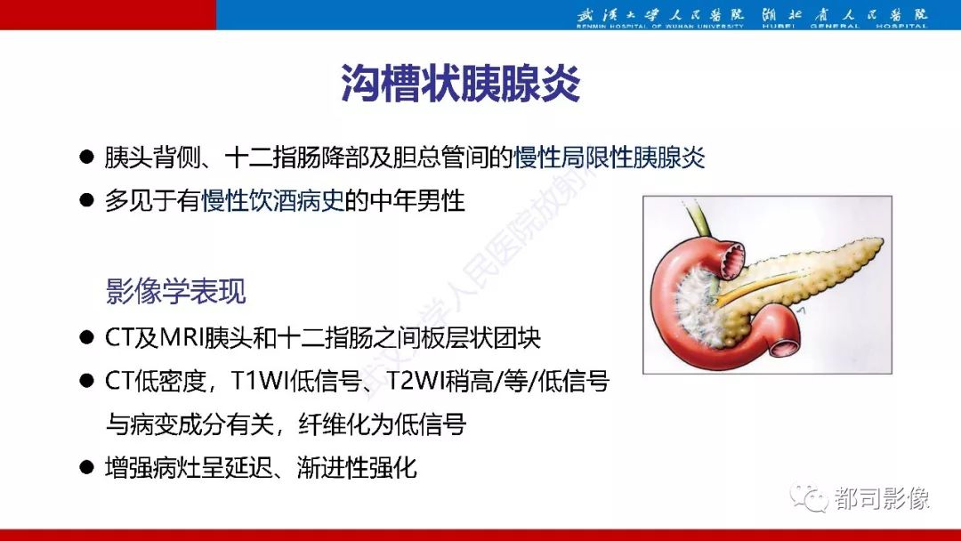 影像PPT - 【PPT】胰腺常见实质性肿瘤临床影像诊断与鉴别-3
