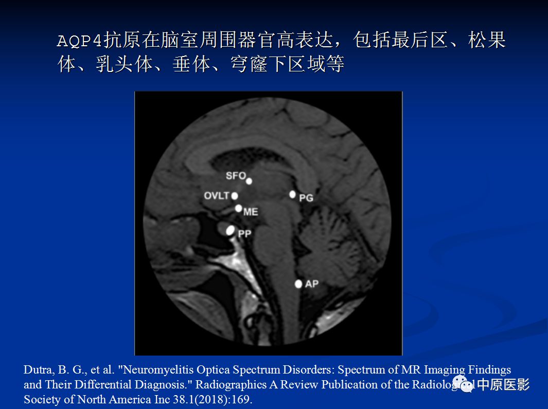 影像PPT - 【PPT】视神经脊髓炎谱系病的MRI诊断-19