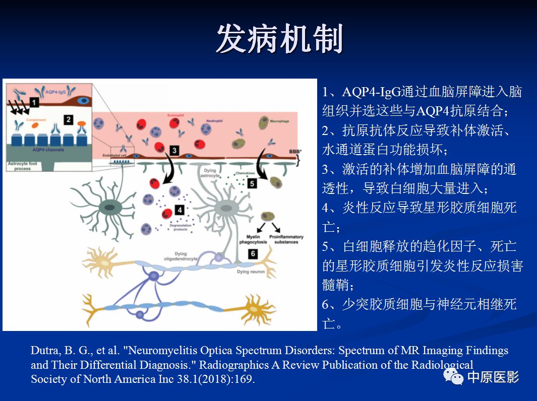 影像PPT - 【PPT】视神经脊髓炎谱系病的MRI诊断-20