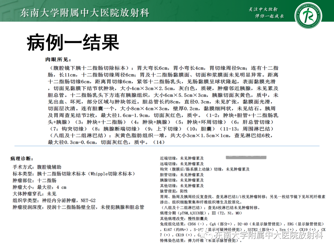 影像PPT - 【PPT】十二指肠占位—病例随访-3