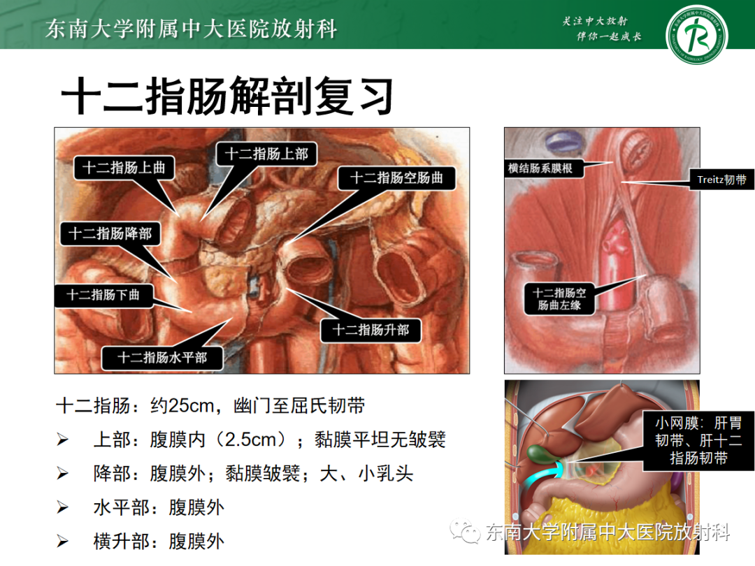 影像PPT - 【PPT】十二指肠占位—病例随访-13