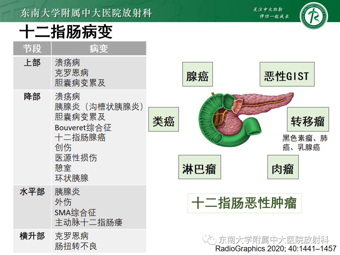 影像PPT - 【PPT】十二指肠占位—病例随访-14