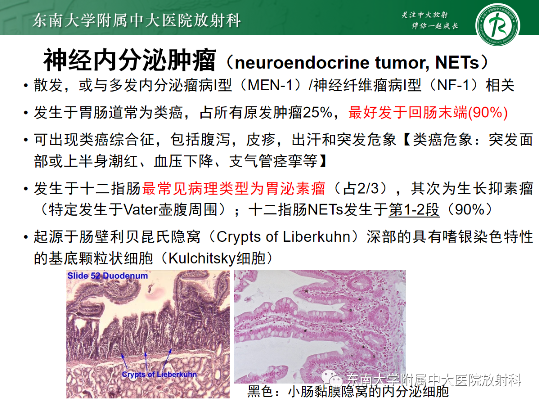 影像PPT - 【PPT】十二指肠占位—病例随访-16