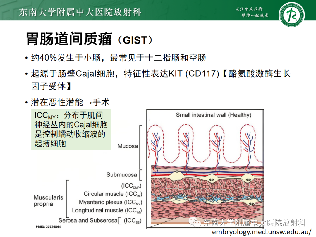 影像PPT - 【PPT】十二指肠占位—病例随访-27
