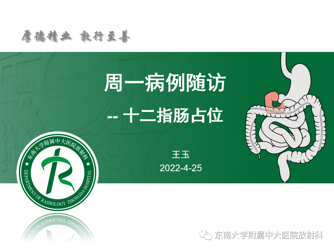 影像PPT - 【PPT】十二指肠占位—病例随访-1