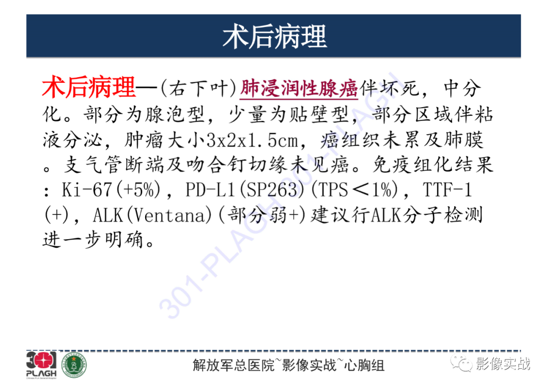 影像PPT - 【PPT】肺浸润性腺癌1例CT-24