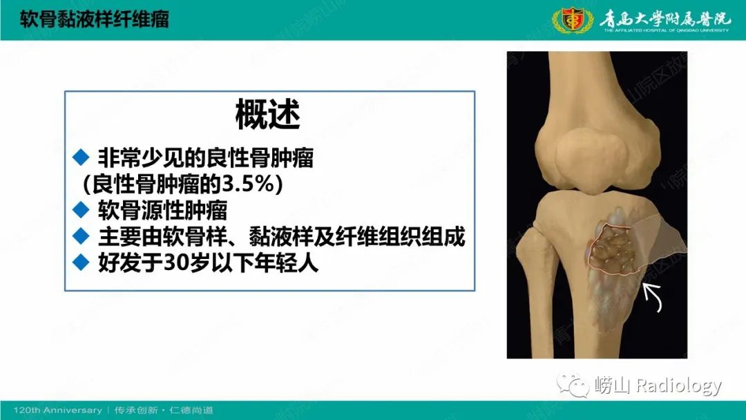 影像PPT - 【PPT】纤维命名相关骨肿瘤和肿瘤样病变的影像学鉴别诊断-31