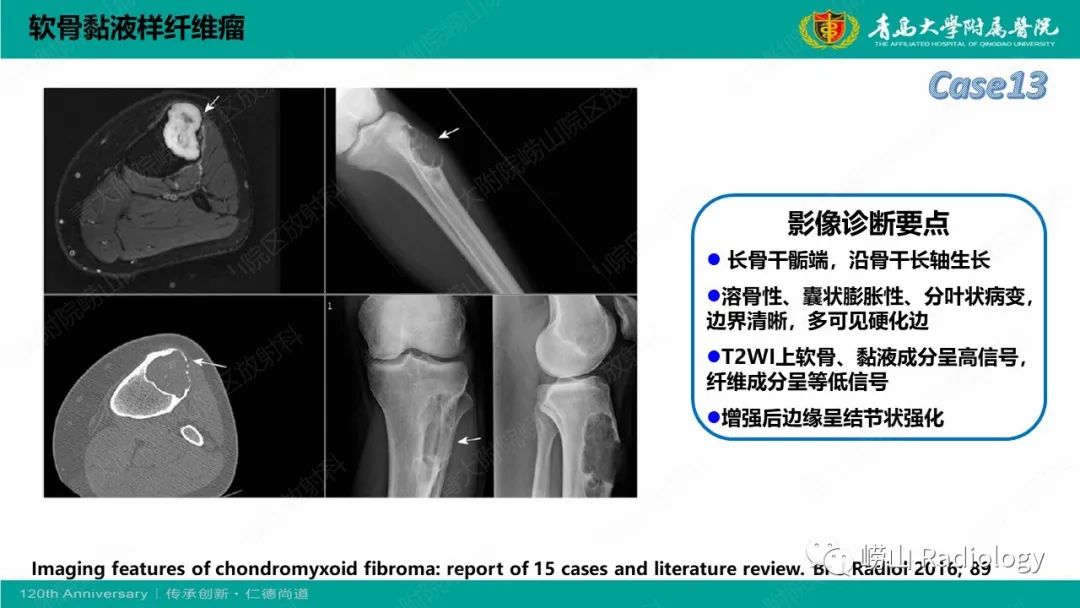 影像PPT - 【PPT】纤维命名相关骨肿瘤和肿瘤样病变的影像学鉴别诊断-32