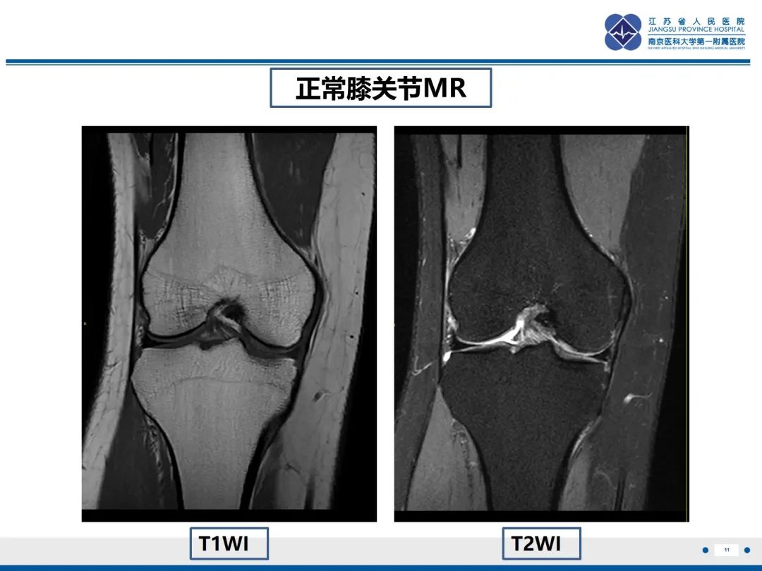 影像PPT - 【PPT】Erdheim-Chester病-12