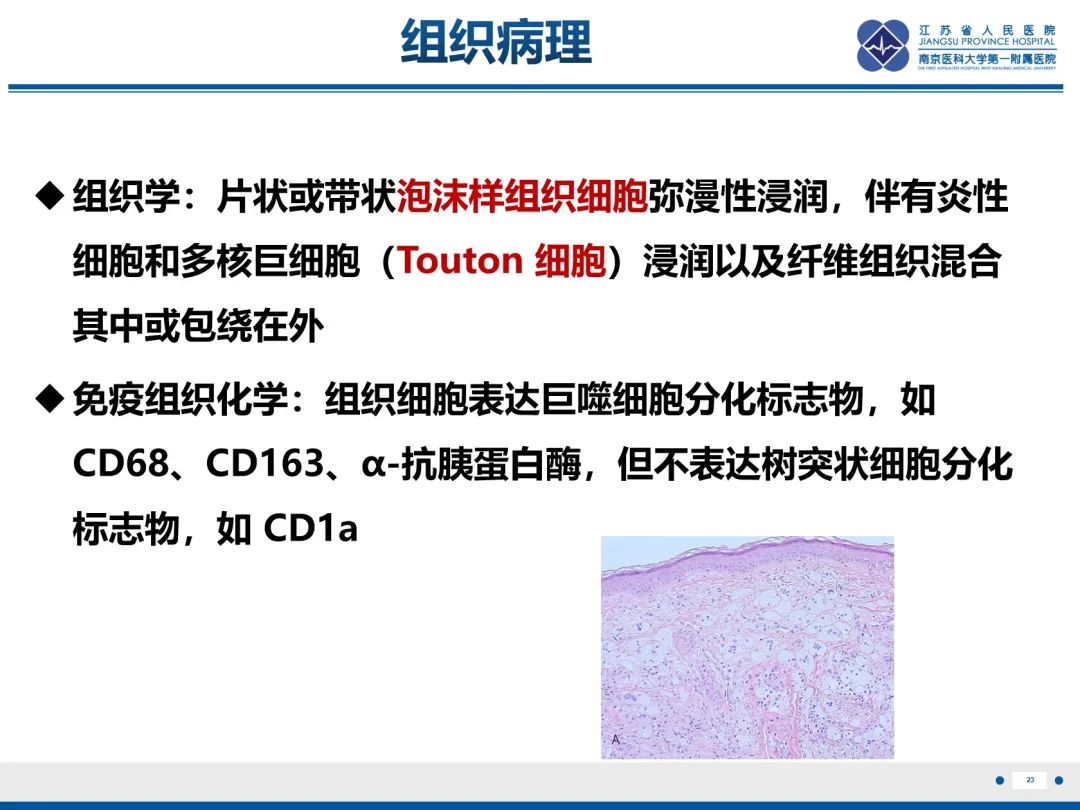影像PPT - 【PPT】Erdheim-Chester病-24