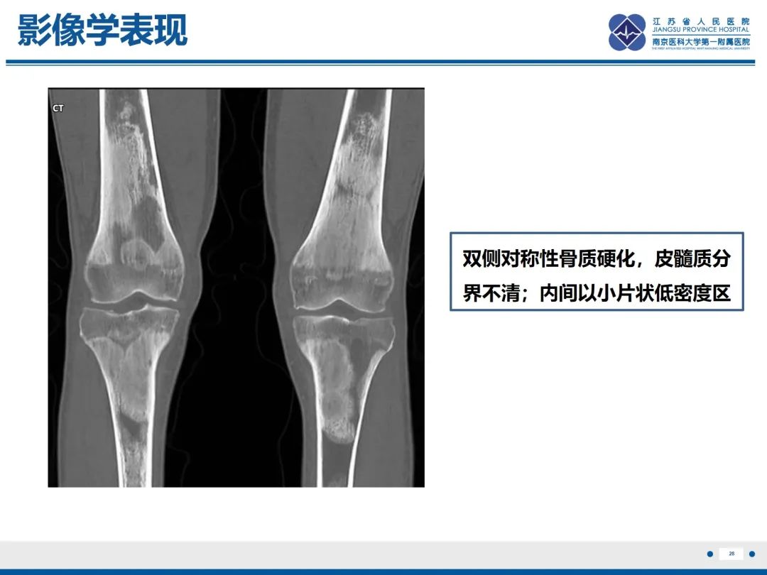影像PPT - 【PPT】Erdheim-Chester病-29