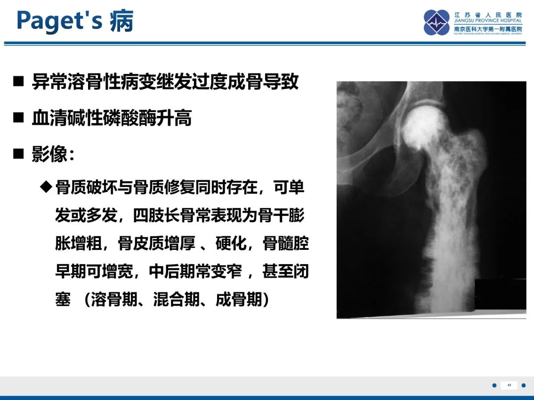 影像PPT - 【PPT】Erdheim-Chester病-42